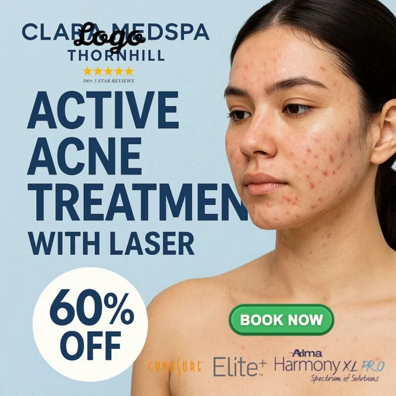 Active acne laser treatment Clara medspa Thornhill — ad creative designed by MetaBaz