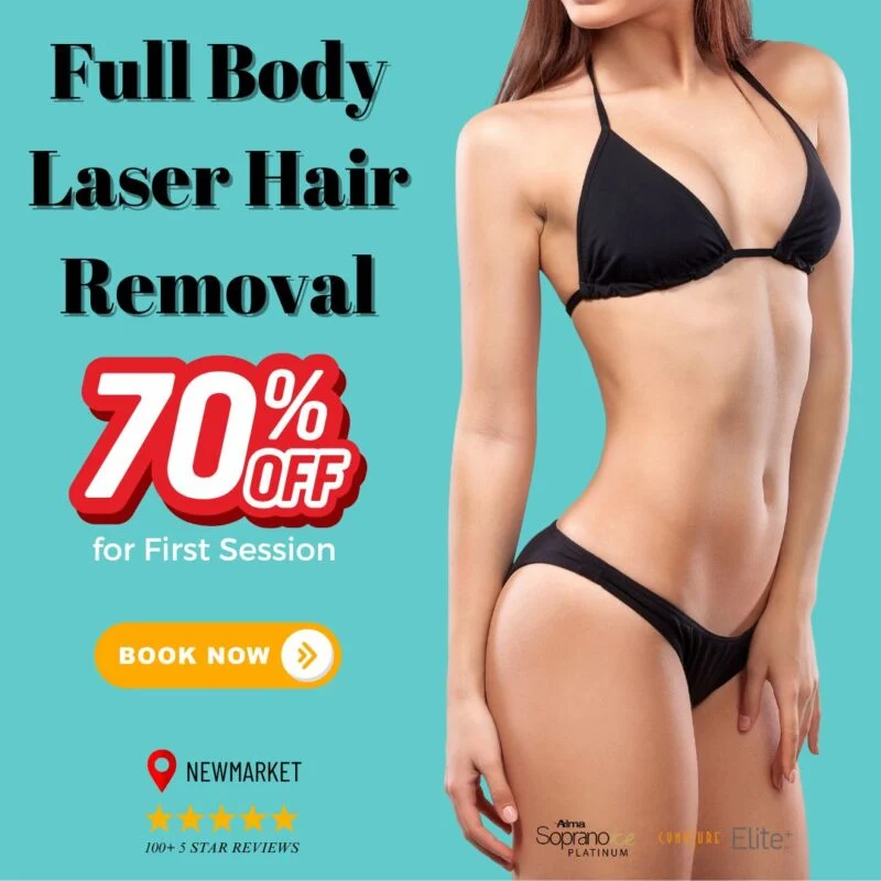 Full body laser hair removal Newmarket deal.jpg — ad creative designed by MetaBaz